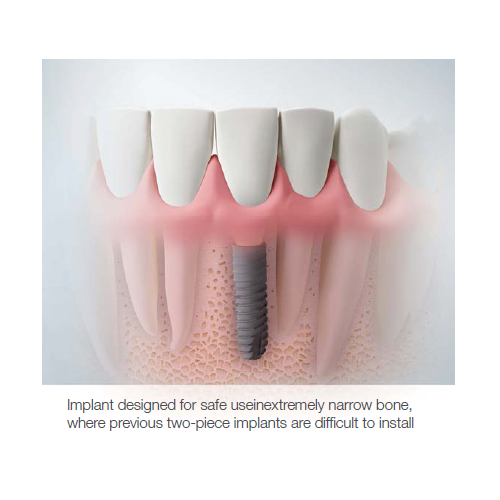 Osstem Med Ny Diameter Til TSIII ø3.0mm - MaxFac Dental AS - OSSTEM